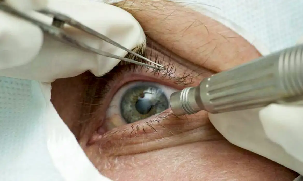 Casos de cegueira após cirurgias em Salvador sobem para 13