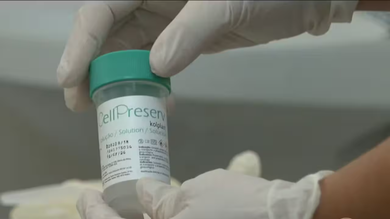 Camaçari inicia exame inédito no SUS para prevenir câncer de colo