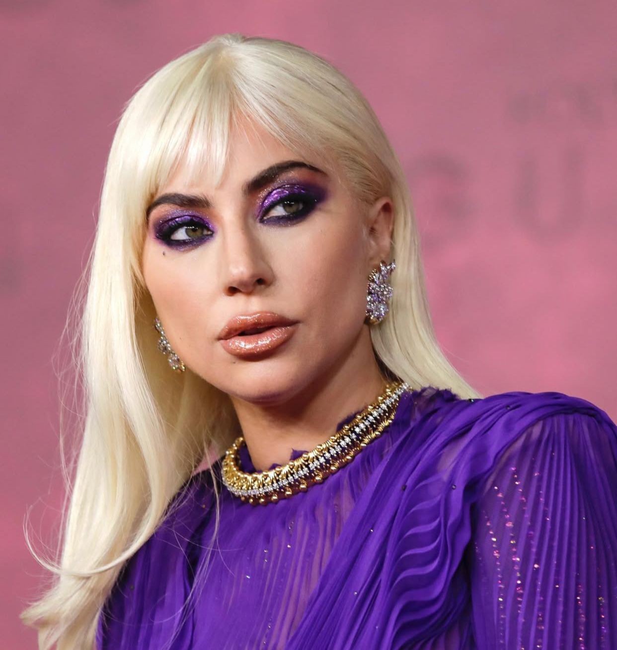 Foto Lady Gaga revela surto psicótico que motivou cancelamento no Rock in Rio