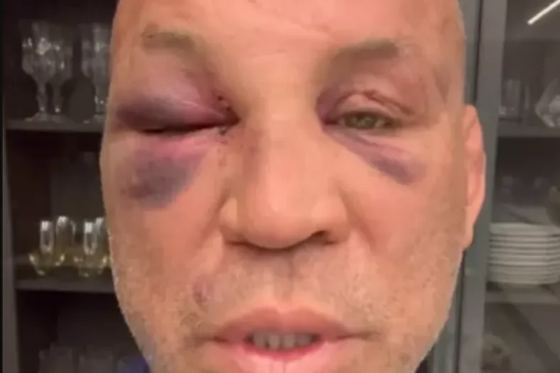Foto Wanderlei Silva expõe dores e anuncia ações após confusão com Popó