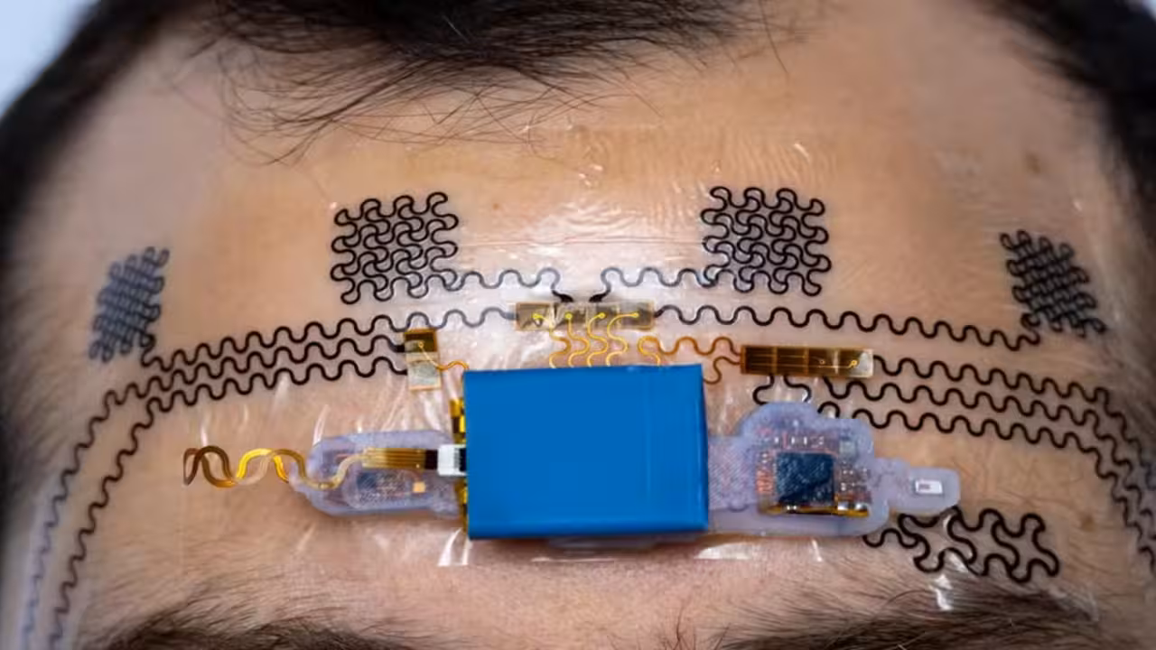 Tatuagem eletrônica detecta ansiedade em tempo real